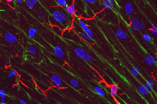 Microglial_cells_(red)_in_rat_cerebellar_molecular_layer