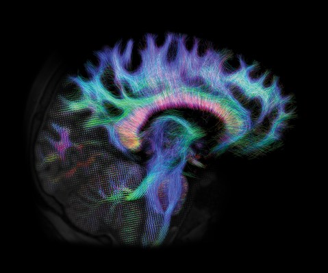 40609625295_8d52b9a304_o